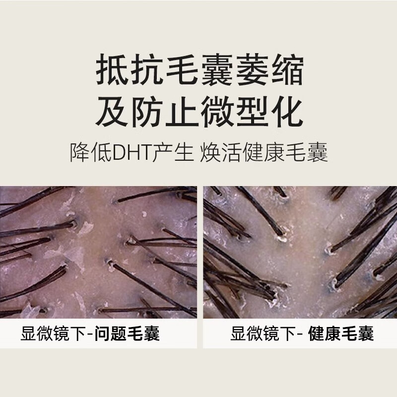 海瑟薇 HASERVEY姜汁新升级洗发水洗头膏柔顺控油去屑蓬松止痒持久留香 控油蓬松洗发水460ml