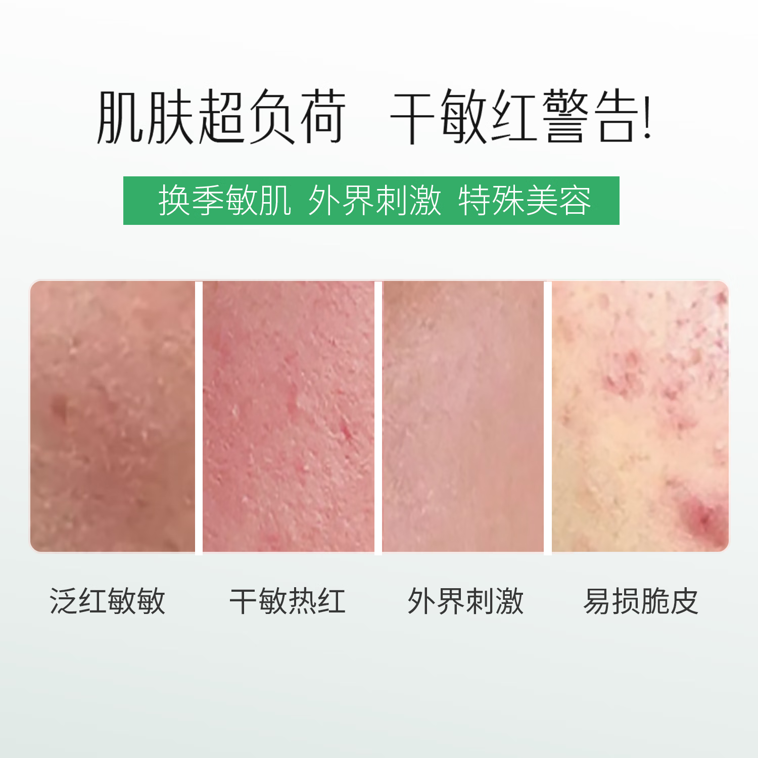 自然攻略依克多因舒敏修护面膜敏感肌舒敏保湿补水舒缓熬夜红脸 1盒 【尝鲜装】