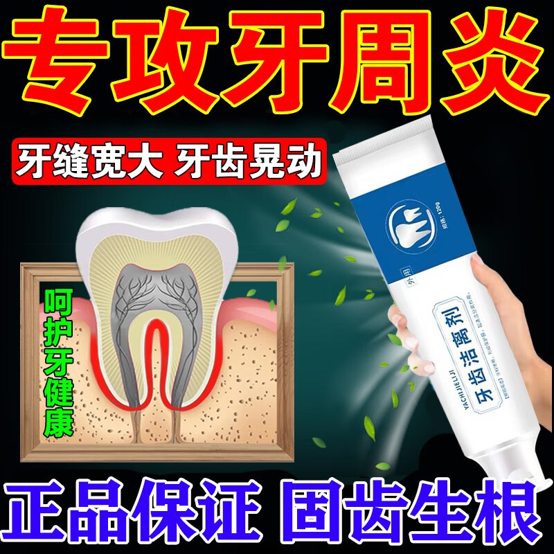 牙周炎专用牙膏固齿牙齿松动牙龈萎缩修复牙龈出血牙膏 3盒【固齿装】