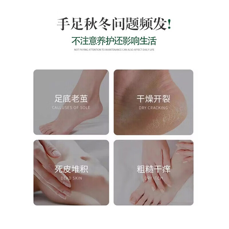 安兴堂冻疮膏防裂护手霜防脚后跟开裂脱皮保湿搭防冻去痒 10罐装
