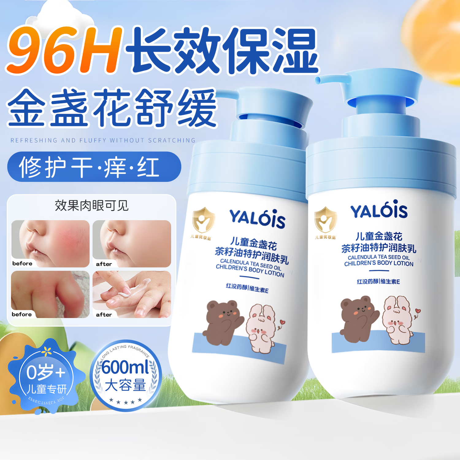 YALOIS凡士林儿童金盏花倍护润肤乳600ml四季婴幼儿身体乳面霜保湿修护