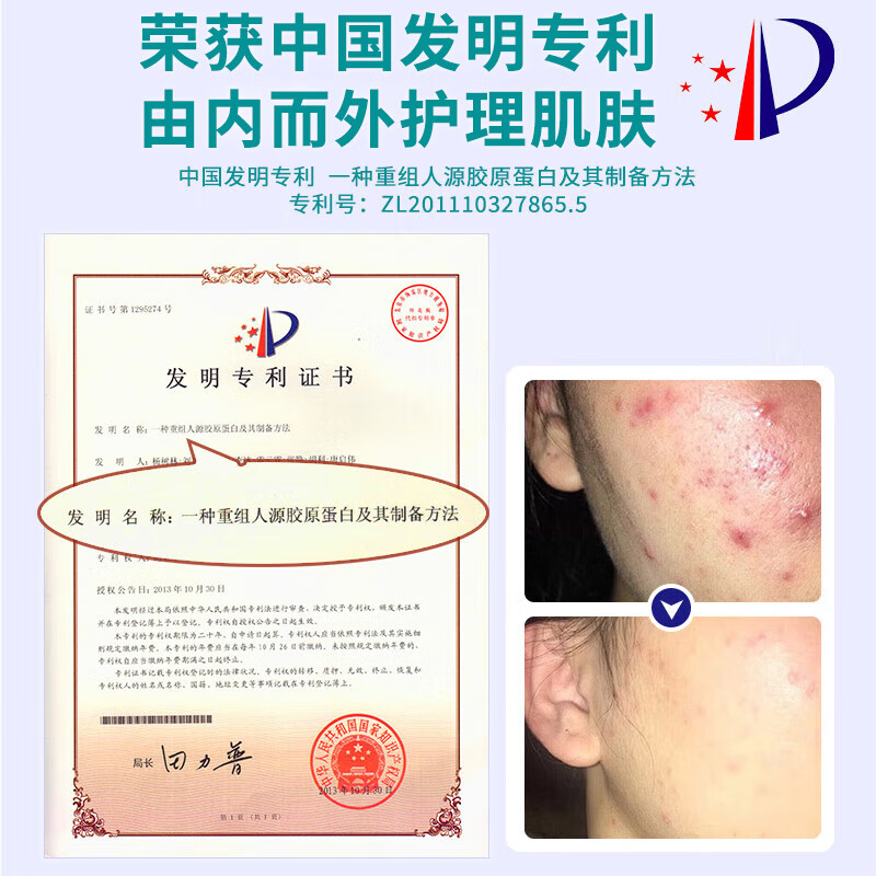 莘护药业 械字号医用重组胶原蛋白冷敷贴面部膜敏感肌医美水光针修护二类 【医用无菌】3盒到手15片