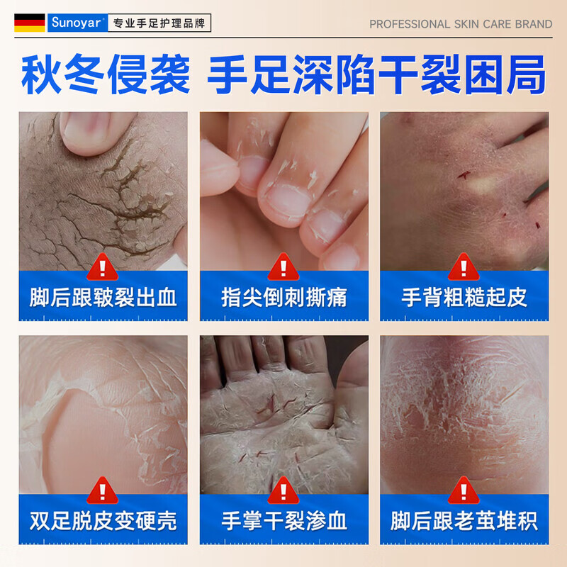 Sunoyar德国维E马油防裂膏手足裂干裂脚后跟开裂护手硬皮跟皲裂 1盒装【局部适用】德国品质医研级防干裂滋润