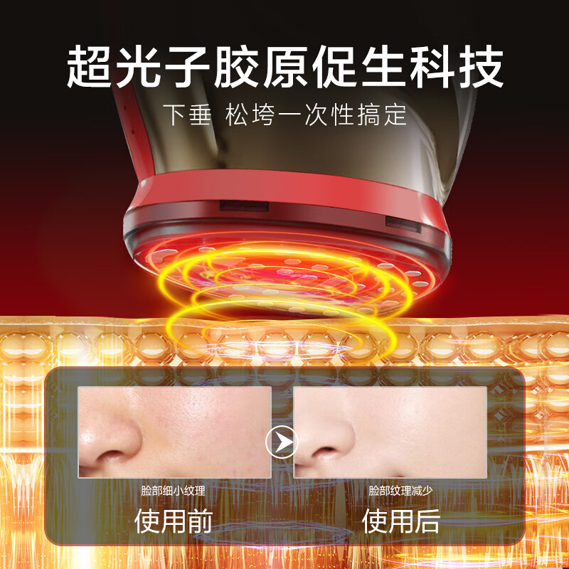 欧菲丽美超声波胶原炮美容仪器家用脸部导入仪嫩肤面部提拉紧致淡纹促成胶原 胶原炮四代【黑金款 抗初老 | 紧致淡纹】