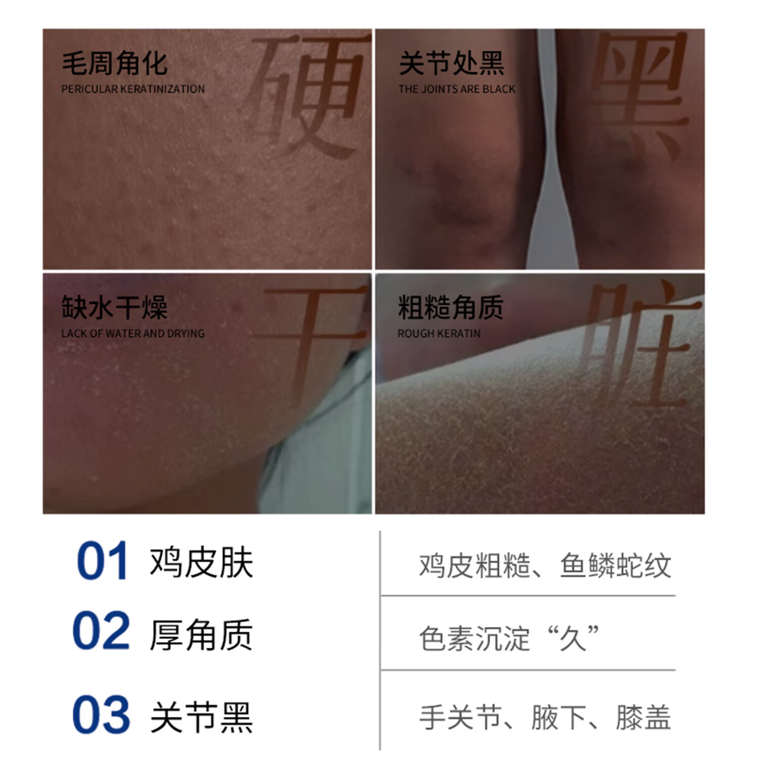 斯诺舟维e尿素乳霜改善肌肤暗沉无光黑色素沉淀去鸡皮 3支囤货日常可用【保湿去鸡皮】