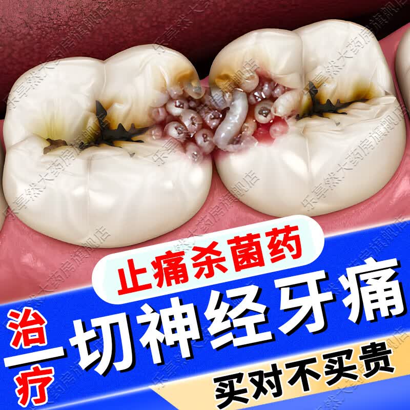 牙疼药快速止痛 牙痛消炎止痛药牙龈肿痛治疗一切神经性防牙痛虫牙防
