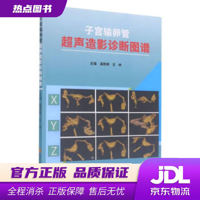 子宫输卵管超声造影诊断图谱 温艳婷,王仲
