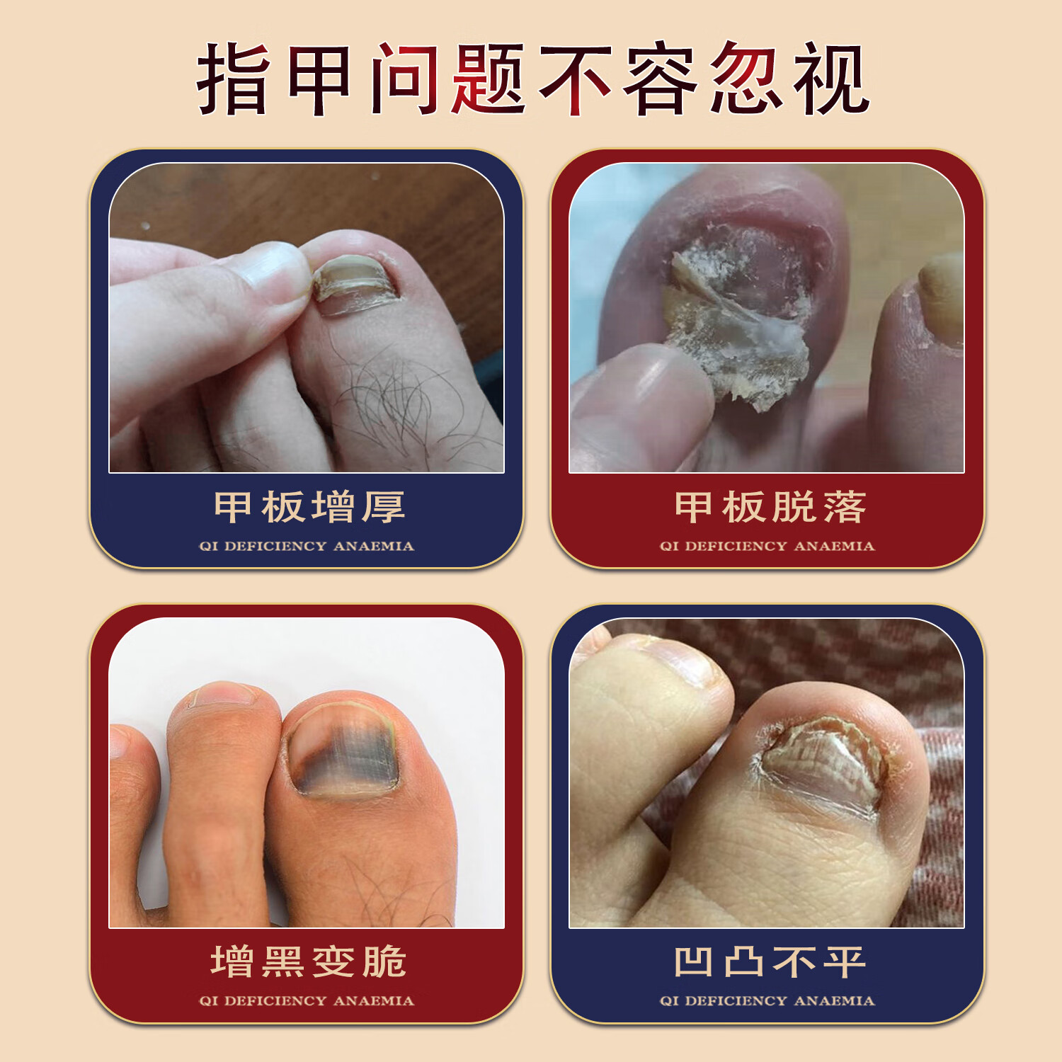 凤仙花官方旗舰店凤仙花抑菌液灰指甲外用保健液套装温和吸收草本精华 10ml*3(多买优惠)