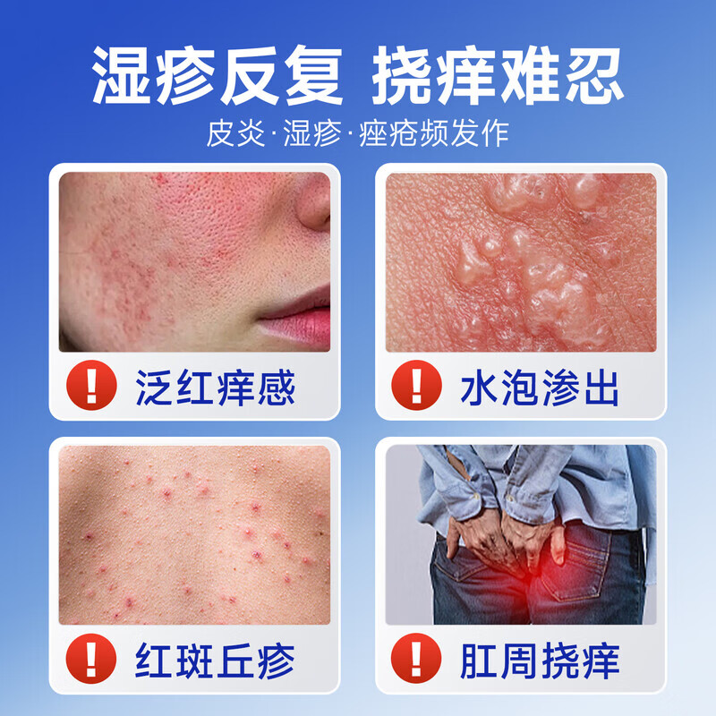 香港大药房湿疹膏搭湿疹药膏皮肤瘙痒皮炎湿疹真菌王感染止痒皮癣阴 单盒【轻度湿疹】体验装