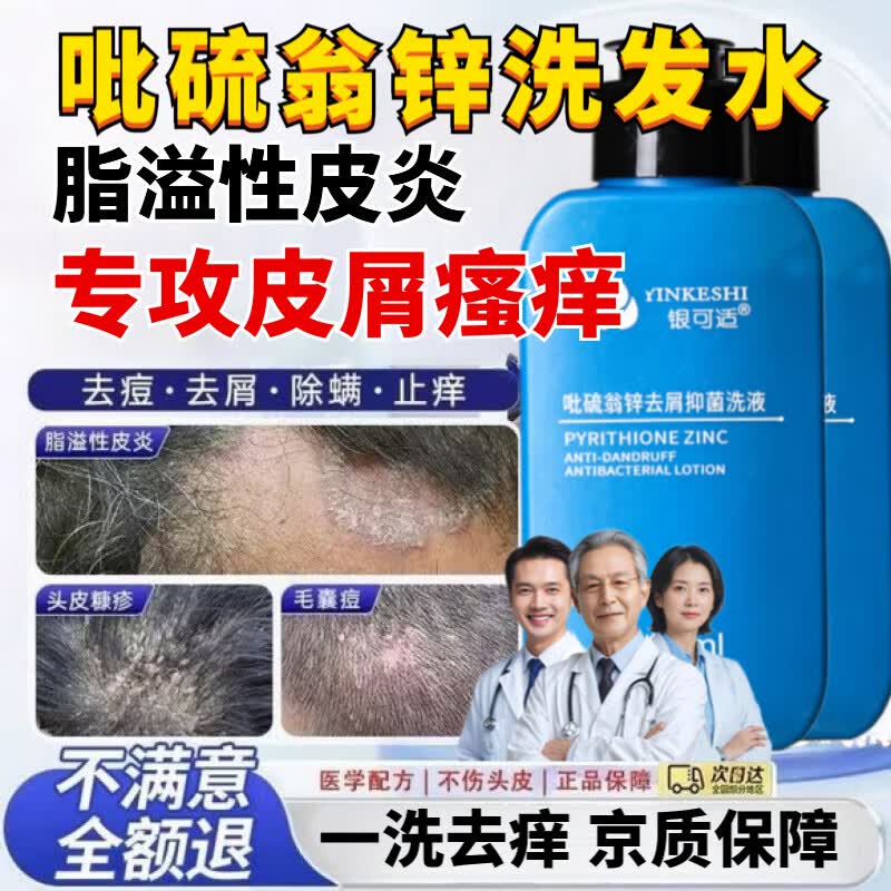 梦妃欧吡硫翁锌洗发水去屑洗发露抑菌喷剂气雾剂毛囊炎止痒脂溢性皮炎