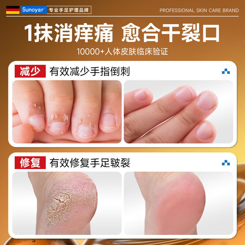 Sunoyar德国维E马油防裂膏手足裂干裂脚后跟开裂护手硬皮跟皲裂 1盒装【局部适用】德国品质医研级防干裂滋润
