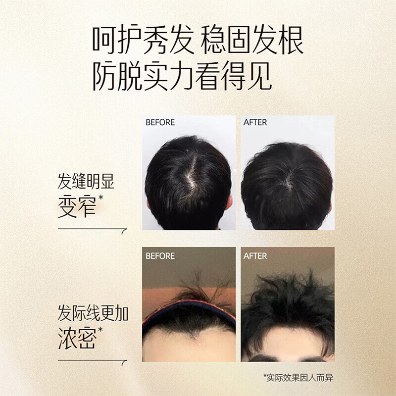 养元青洗发水控油强根健发去屑黑葫芦强韧蓬松金葫芦防脱洗发乳 【短发防脱】强根健发210ml