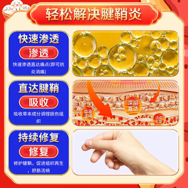 岩井昃弘腱鞘炎专用膏药凝胶大拇指手指疼痛鼠标手护手腕妈妈手腱鞘炎喷雾 5瓶装【买三送二】周期巩固型 腱鞘炎贴大拇指手指关节疼痛特效