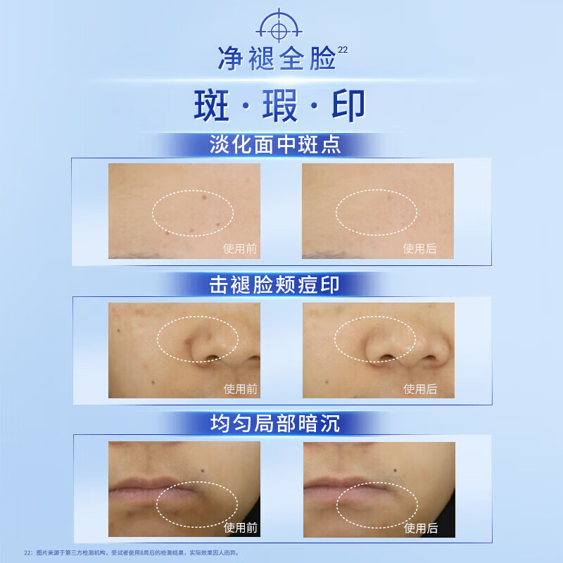 妮维雅(NIVEA)【No.1淡斑精华】 630淡斑淡痘印美白精华改善暗沉补水护肤品礼物 630淡斑精华30ml