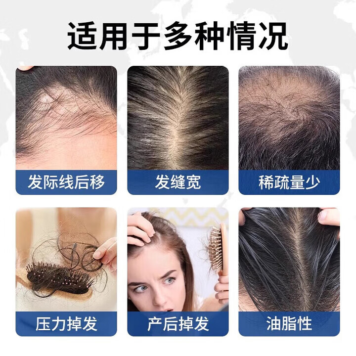 Minoxidil泰版米诺地尔口服生发片焕活毛脂溢性脱发地中海防脱发密发固发  新款升级泰国版  100片 10mg*1盒