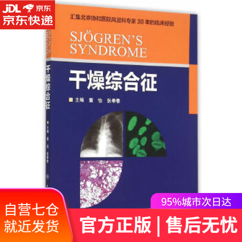 【新华书店】干燥综合征 董怡,张奉春主编 人民卫生出版社