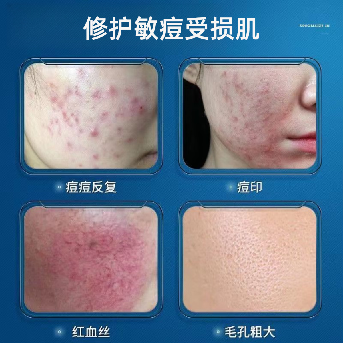 修正冻干粉敏感肌痘肌痘印干痒泛红红血丝烟酰胺寡肽修护冻干粉6瓶/盒 3盒【烟酰胺寡肽修护冻干粉】