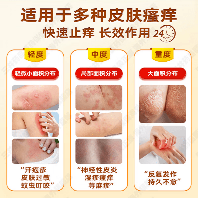 LQTMSZ氟芬那酸酸丁酯软膏布特10g2盒装20g抗皮肤过敏性瘙痒湿疹泛红 1支【见效装】 【京营大药房 京质保障】