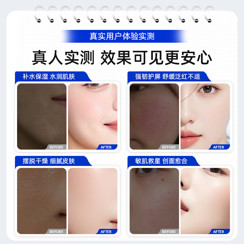 盛姿颖医用重组人源化Ⅲ型胶原蛋白敷料舒缓肌肤敏感泛红痤疮创面修护 胶原蛋白敷料30g/瓶