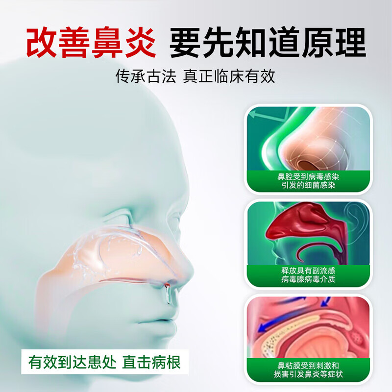 Sunoyar英国儿童鼻炎贴儿童鼻炎舒鼻贴过敏性鼻炎鼻塞鼻窦炎穴位贴 10盒装【买5送5超划算】长效巩固养护鼻腔