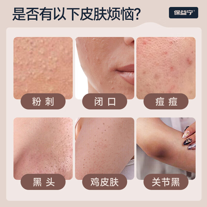 LQTMSZ维a酸乳膏尿素软软膏【官方旗舰店】组合去鸡皮去黑色素维e乳霜丽 5套【维A酸乳膏 尿素维E】家庭巩固装 【官方直售 京质保障】