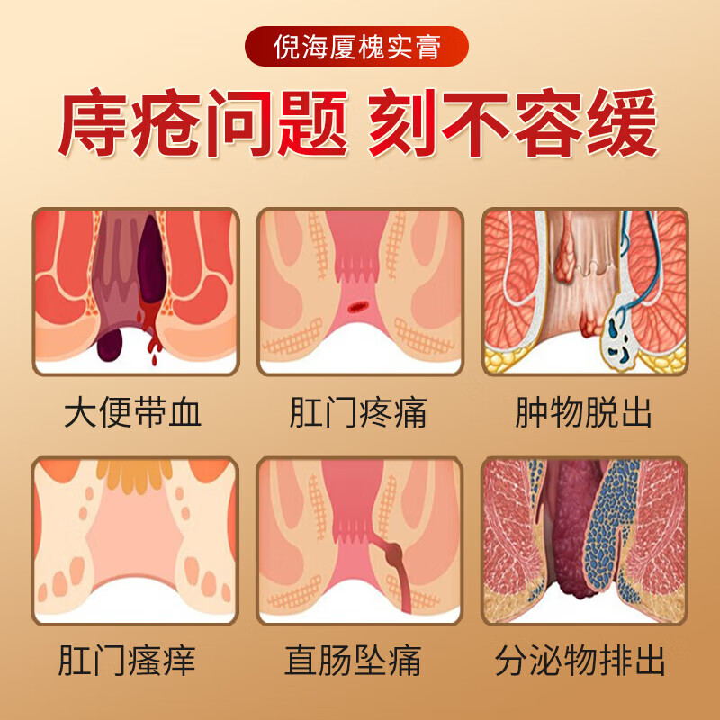 方苓堂抑菌膏痔疮药膏男女消肉球断痔膏内痔外痔痣断去肉球神器 五盒【巩固装】买三送二 【药房同售】