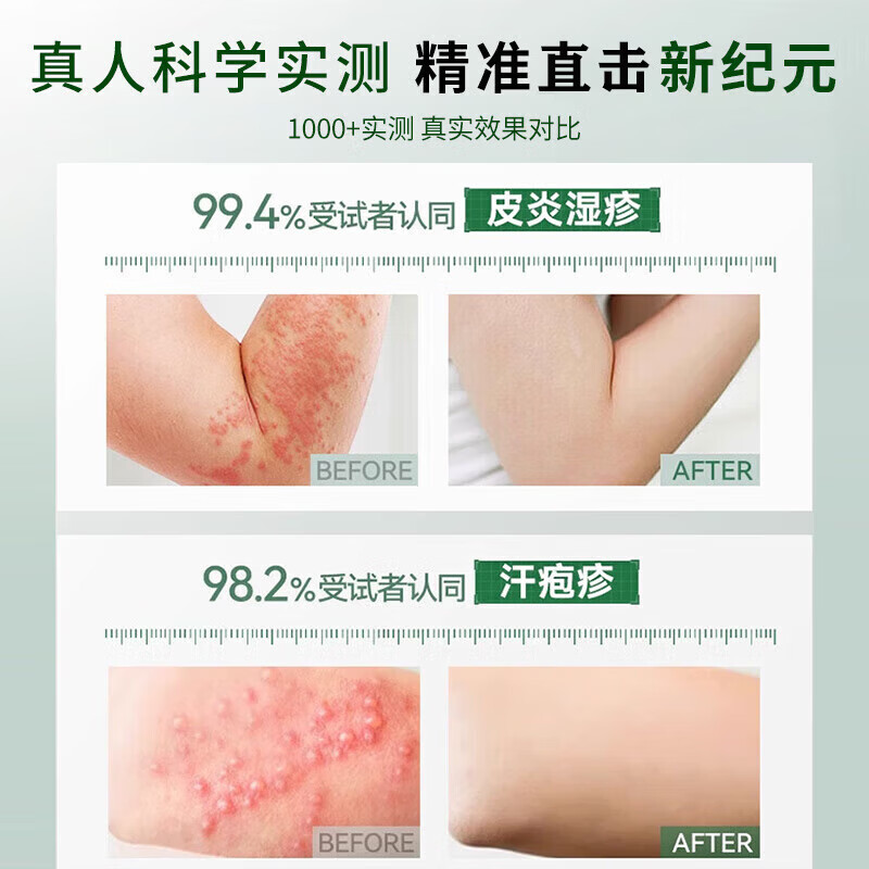 岩井昃弘湿疹膏十大牌子进口湿疹膏止痒抑菌皮肤瘙痒去顽固湿毒真菌感染 特效3盒【100%一抹见校】湿疹膏药十大牌子 湿疹十大牌子皮肤瘙痒皮炎湿疹