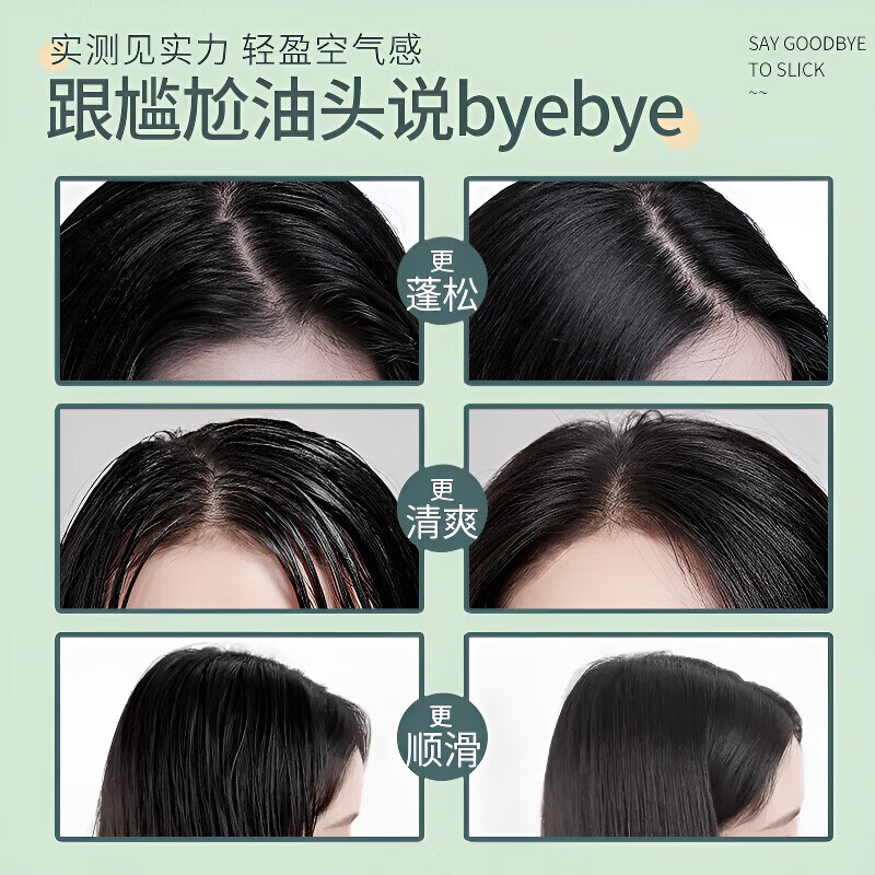 ZYUO日本干发喷雾控油蓬松免洗头发喷雾定型神器懒人油头塌头发蓬松粉 5瓶装【囤货钜惠装】高能蓬松 速干无痕