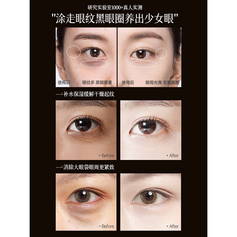 Sunoyar抗皱眼霜淡化细纹提拉紧致黑眼圈眼袋霜去大眼袋严重中老年专用 5盒装【均价41.4】缺水干纹浮肿眼袋