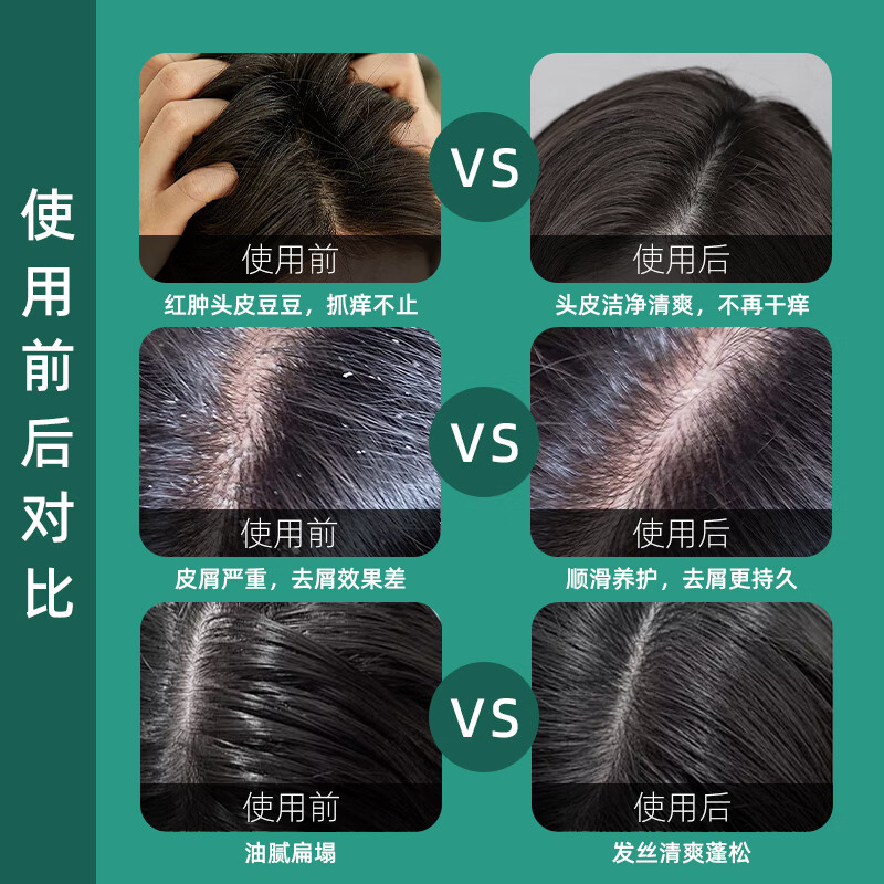 歌澜艾叶去屑净爽洗发水柔顺大容量植物草本免蒸水润霜套装洗发露 歌澜艾叶护发素   两瓶