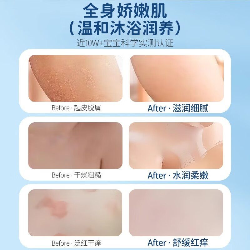 寻香博士儿童沐浴露洗发水洁面乳婴儿洗护沐浴套装山茶油控油除螨保湿滋润 【儿童小金盾】儿童维C沐浴露800mL