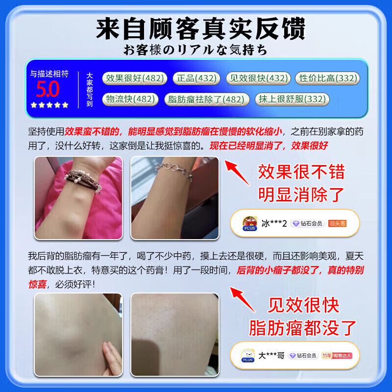 云南本草脂肪康脂肪瘤专用膏药去除神器消除硬块鼓包脂肪消散膏皮下囊肿 5盒膏【 脂肪瘤终结者】脂肪康 陈九玄脂肪瘤膏皮下多发性鼓包