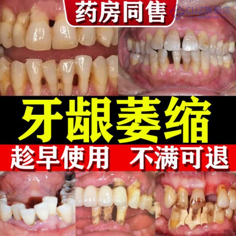 奥朗威修复牙龈萎缩牙膏医用口腔牙科分离剂治牙周牙齿牙龈 5支【买三送二  周期护理】 官方授权