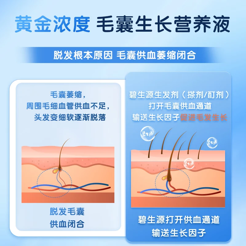 [碧生源]米诺地尔搽剂 5%*60ml 2盒装 5%*60ml/瓶 生发喷雾育发液防脱专用治疗脱发斑秃 送上药器 推荐购买