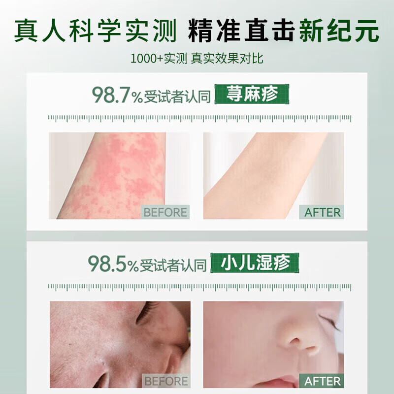 岩井昃弘湿疹膏十大牌子进口湿疹膏止痒抑菌皮肤瘙痒去顽固湿毒真菌感染 特效3盒【100%一抹见校】湿疹膏药十大牌子 湿疹十大牌子皮肤瘙痒皮炎湿疹