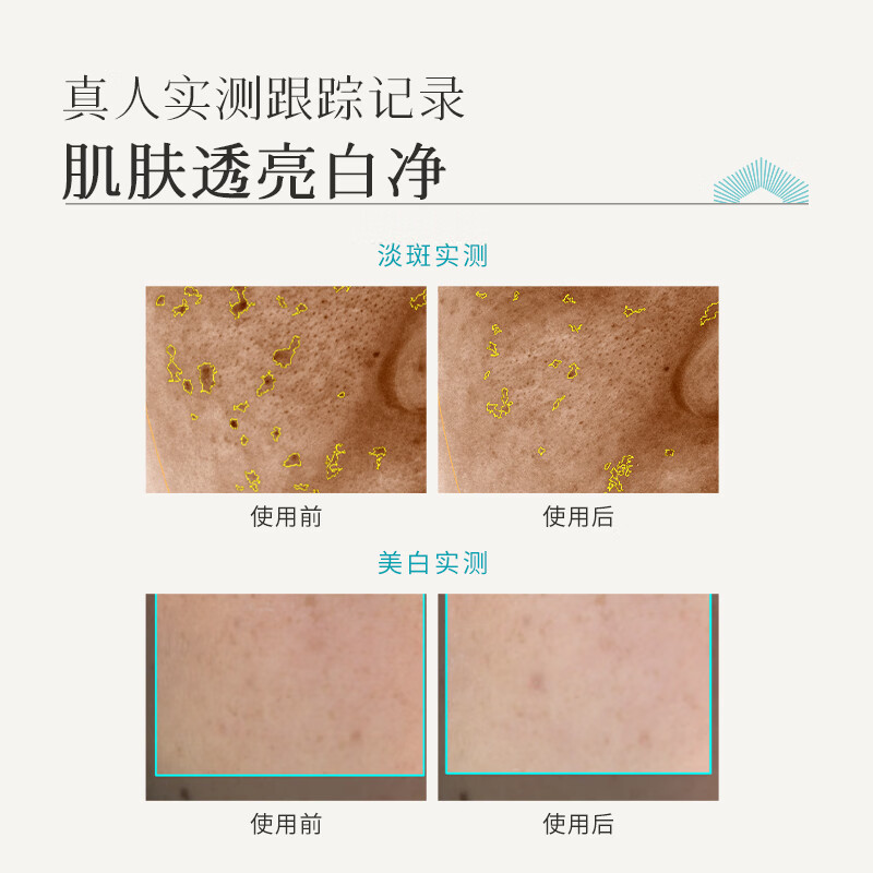 枫缇（Ble de Fonty）淡斑美白精华油 祛斑透亮肤嫩白舒缓温和敏肌可用 618活动