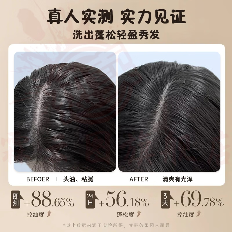 思亚希泊萃丝洗发水防脱育发草本滋养控油蓬松强韧发丝修复受损官方正品 5瓶装【重度脱发必选】买五贈五 官方直售