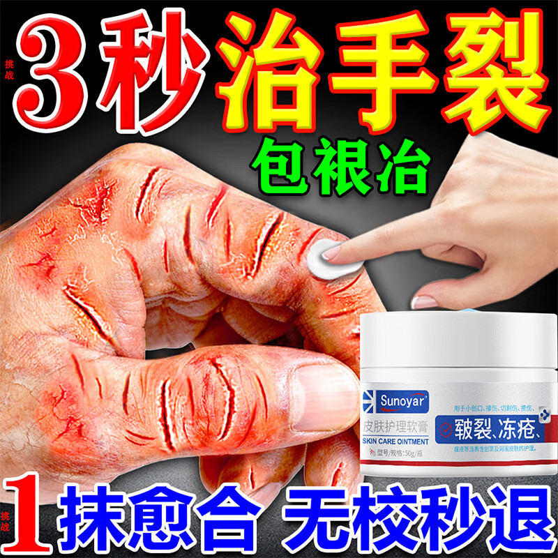 Sunoyar凡士林手足干裂脚裂膏脚后跟干裂开裂皲裂膏防冻疮防裂膏 5盒装【买3送2】拒绝粗糙防止干裂 京东折扣/优惠券