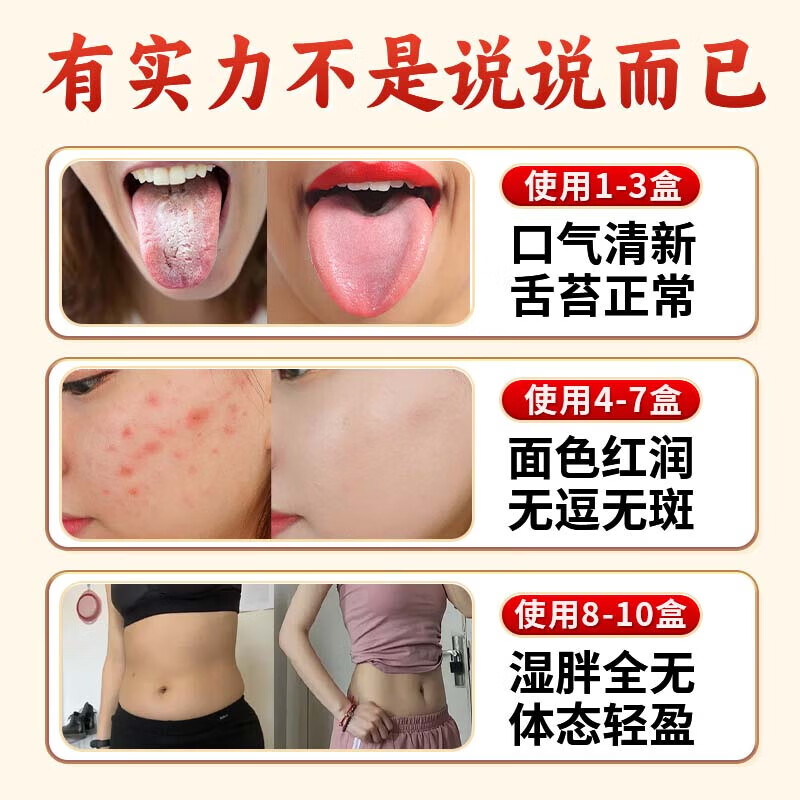 朕皇山楂茯苓颗粒祛湿减肥排毒瘦肚子中药祛湿气重湿疹健脾开胃湿阻脾 【健牌祛湿调肠胃】 150g*1盒 体验装