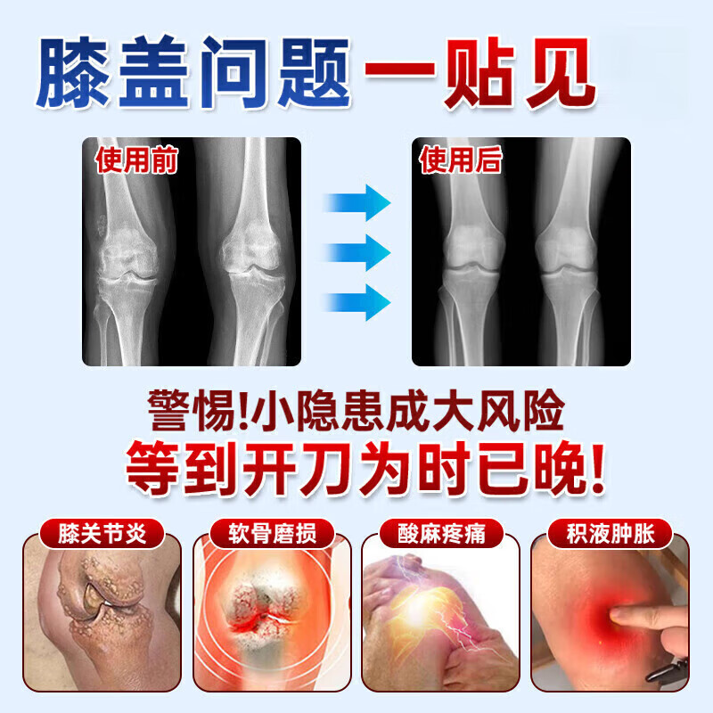 臧域奇秘方藏远红外治疗贴膝盖贴型止痛贴热敷筋骨疼痛膝盖膝加热 3盒巩固装