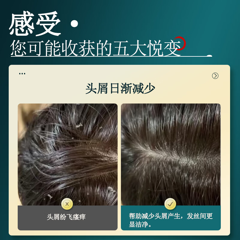侗百谷二硫化硒洗发水控油蓬松去屑护发素止痒留香修护毛躁龙脑液沐浴露 控油去屑】龙脑香氛洗发水500ml