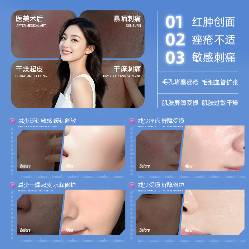 盛姿颖医用重组III型人源化胶原蛋白修复敷贴激光术后果酸换肤深层修复 修护贴3盒15片装