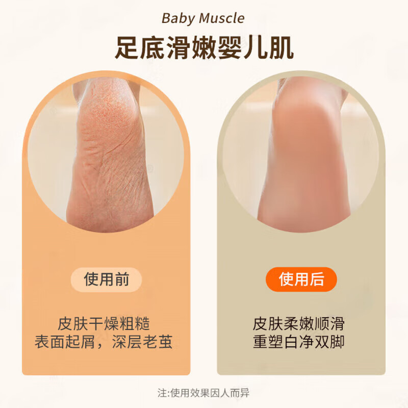 AILUKI【法国】电动磨脚器磨脚去死皮老茧脚后跟修脚器去脚部硬皮搓脚皮打磨修足器重力感应保护双档调速 橙色-配磨头*3【厚硬死皮不伤肉】