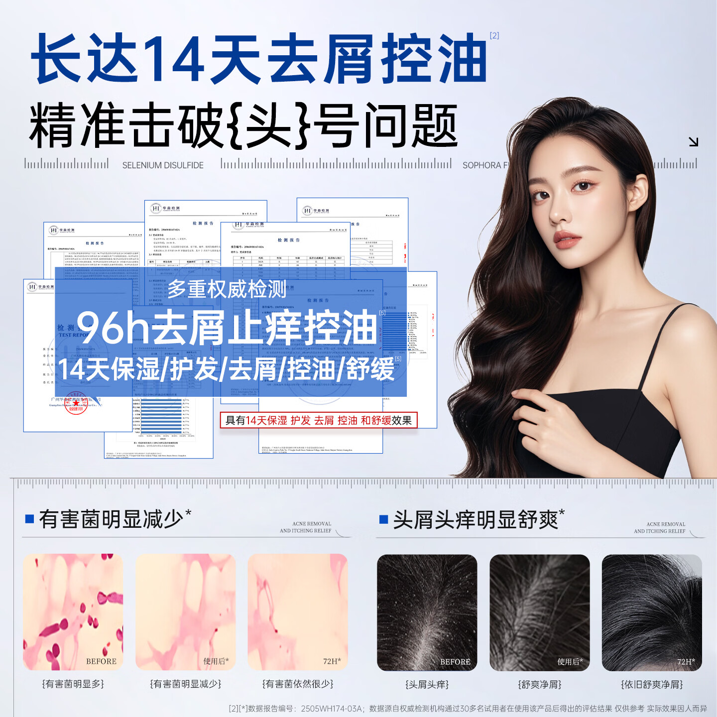 云康二硫化硒净屑调理洗发露去屑止痒控油清爽蓬松洗发水官方正品 二硫化硒净屑调理洗发露260g