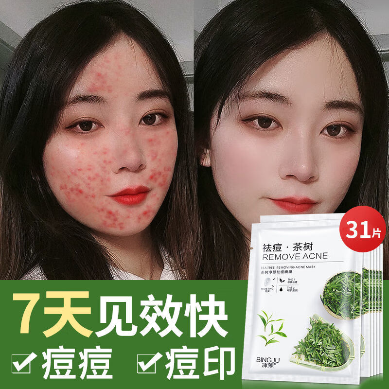 天然茶树补水面膜补水修复熬夜油性皮肤痘痘肌淡化痘印面膜贴 31片