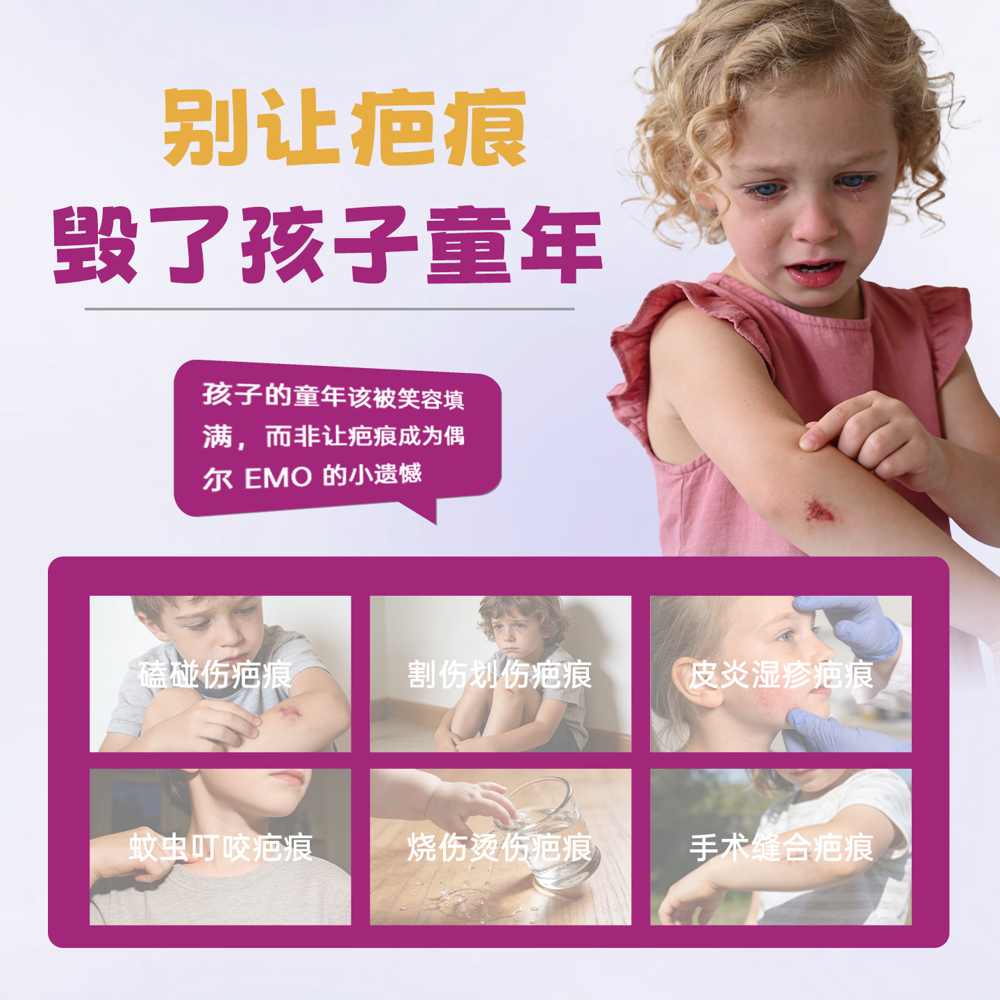 润好儿童祛疤硅凝胶手术烧烫伤新旧创伤磕碰疤痕去疤除疤医用自风干型 儿童款30g1支体验装【轻微小面积疤痕淡化】