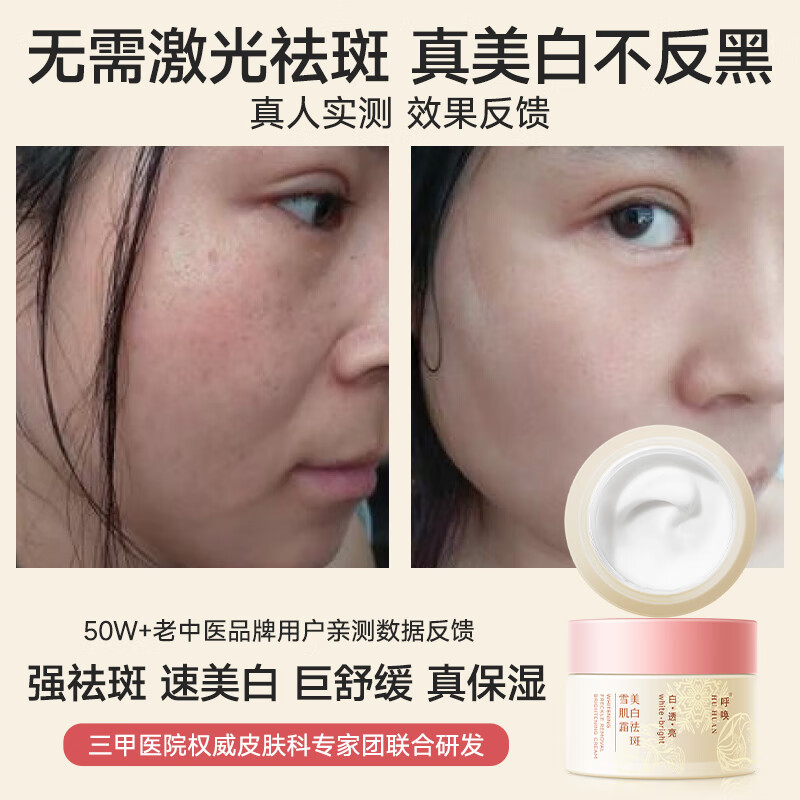 老中医（LAOZHONGYI）呼唤美白祛斑霜烟酰胺面霜色斑淡化黑色素去雀斑黄褐斑护肤品男女 【有效祛斑】呼唤美白祛斑雪肌霜