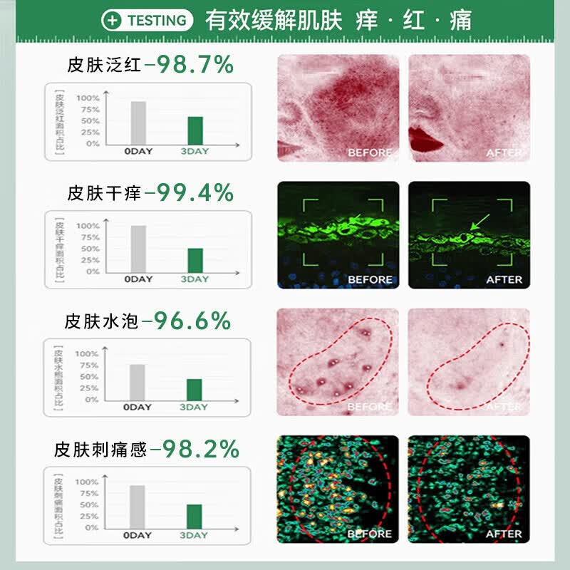 北京协和医学院日本进口湿疹药膏湿毒清皮肤瘙痒皮炎100%真菌王感染去止痒根专用 特效5盒【800%永不反复】湿疹药膏十大牌子 苗药顽固湿疹热疹皮癣婴儿抑菌止痒膏湿疹药膏十大牌子