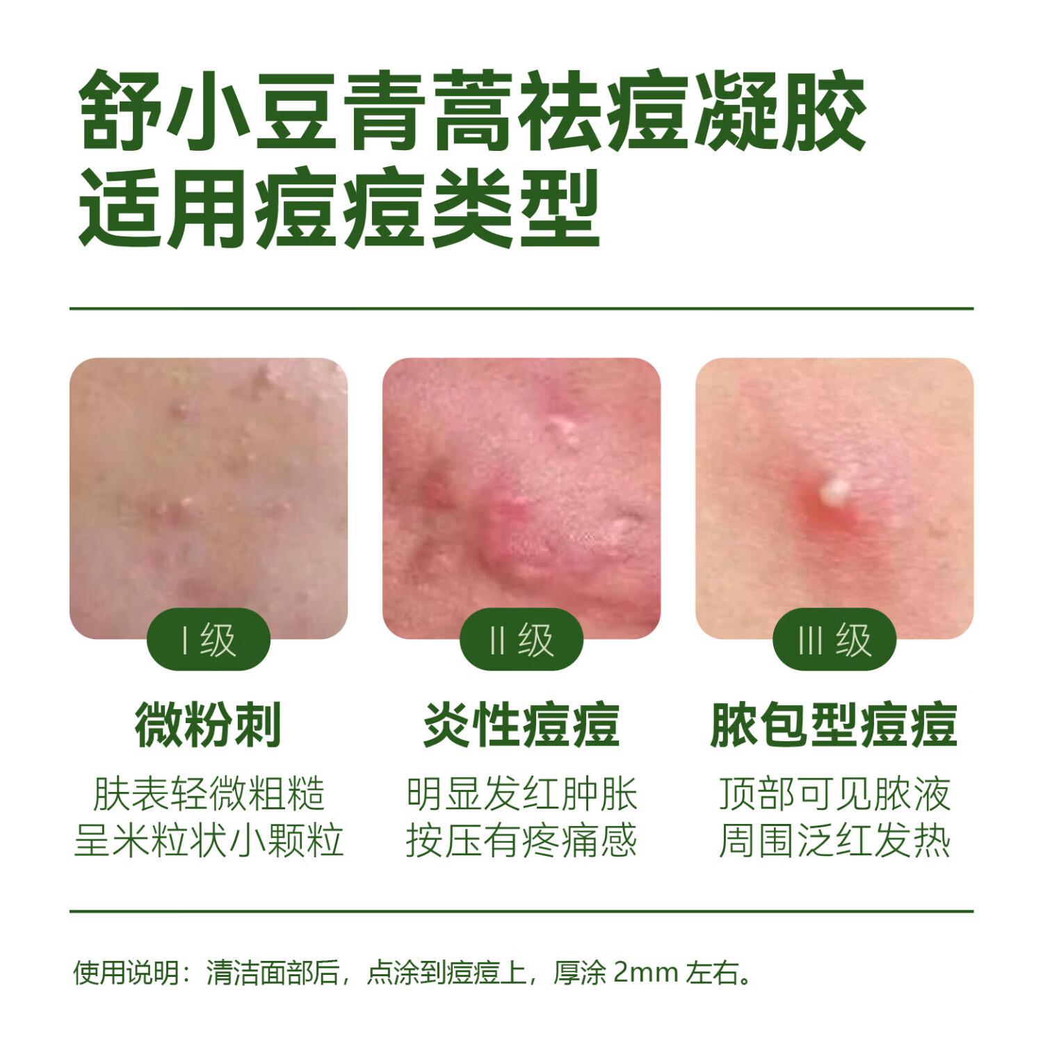 舒小豆青蒿祛痘凝胶25ml/盒无酸敏感肌泛红痤疮痘印草本天然舒缓护肤 1支/盒【正装周期舒缓】