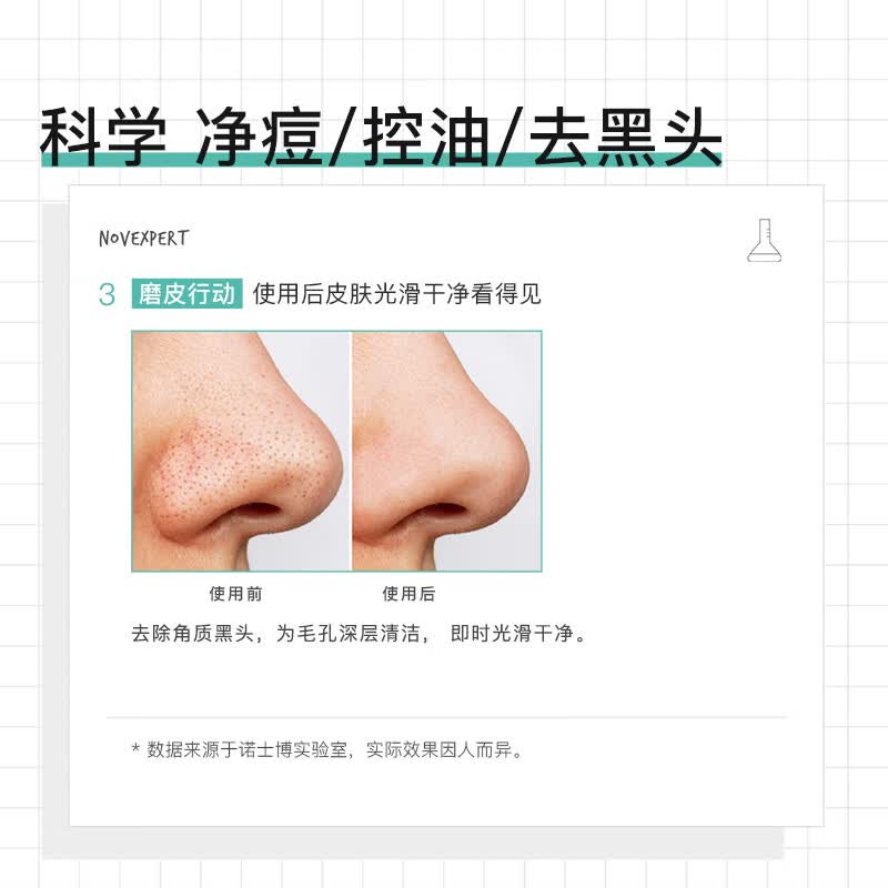 NOVEXPERT诺士博青少年祛痘面膜 淡化痘印去黑头闭口青春期护肤品男女孩70g [单支装]荣获痘痘修护金奖